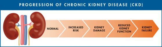 CHRONIC KIDNEY DISEASE   Caritas Medical Center